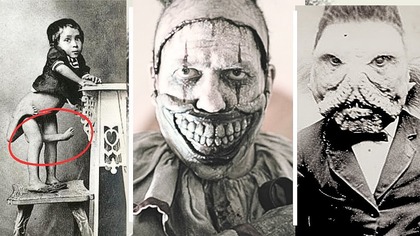 30 Zdjęć Cyrkowych Dziwaków Którzy Naprawdę Istnieli