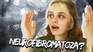 Zgadujemy CZY TAKA CHOROBA ISTNIEJE?