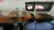 Nieproszony gość w nosie +18