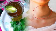 Szybko Przybierasz na Wadze? 6 Łatwych Sposobów Do Naturalnego Leczenia Tarczycy