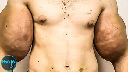 Top 10 Plastic Surgery Nightmares