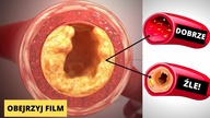 Obniż cholesterol o 70% w zaledwie 2 tygodnie z tymi napojami