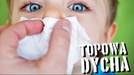 10 nietypowych alergii [TOPOWA DYCHA]