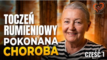 35 lat na Sterydach.  Jak Pokonałam Toczeń Rumieniowy w Akademii.  Część 1.
