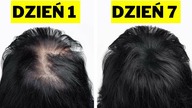 Włosy rosną po tym jak szalone - Naturalne sposoby na gęste włosy
