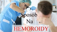 Pozbądź się problemu w tydzień.  Hemoroidy