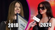 Wszystko jasne! Roxie WĘGIEL zdradza, czy powiększyła usta i jakie zabiegi sobie zrobiła