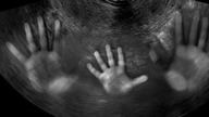 Bóg pokazał nam jakie są skutki grzechu aborcji   świadectwo