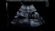 USG CZWORACZKI | USG Children Quadruplets