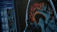 Teen Wolf S03E20
