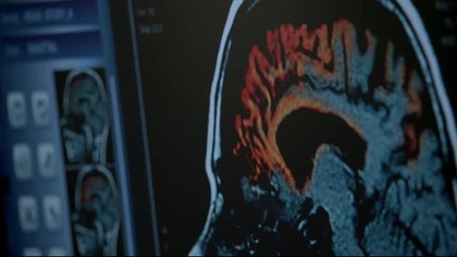 Teen Wolf S03E20