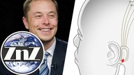 Elon Musk zacznie umieszczanie chipów w mózgach ludzi już w 2022 roku