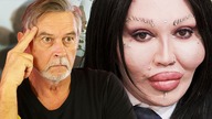 Reagujemy na... OPERACJE PLASTYCZNE