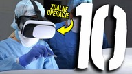 10 nieprawdopodobnych operacji medycznych [TOPOWA DYCHA]
