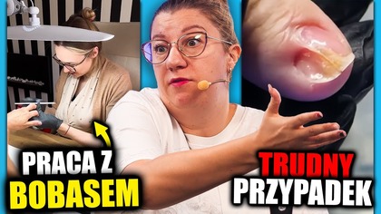 ROBIENIE PAZNOKCI Z DZIECKIEM, FORMY ZA 225 ZŁ, TRUDNY PAZNOKIEĆ | QULOO LUPA