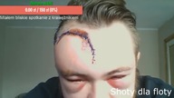 PĘDZEL MIAŁ WYPADEK - WYGLĄDA TRAGICZNIE! - Bystrzak TV