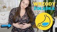 WRZODY ZOŁADKA Operacja to koniecznosc?