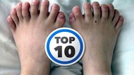 Top 10 naj | Najdziwniejsze deformacje genetyczne!