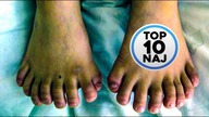 Top 10 Naj | 10 dziwnych deformacji genetycznych! Remake :)