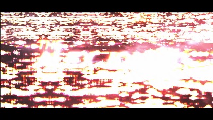 Bill Gates Caught Secretly Implanting The Population With Nanotech!  FULL SHOW 10925