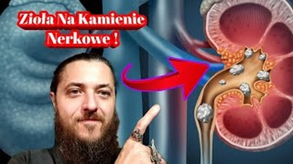 2033.  Zioła I Inne Sposoby Na Kamienie Nerkowe!