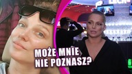Joanna Liszowska zabawnie o medycynie estetycznej