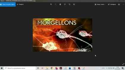 Morgolleony, te robale zjadają ciebie żywcem!