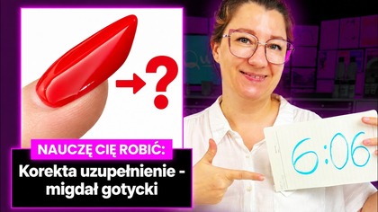 6:06.  KOREKTA UZUPEŁNIENIE (Migdał gotycki)
