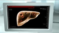 TVN HD- Blok reklamowy i zapowiedzi (23. 01. 2020)