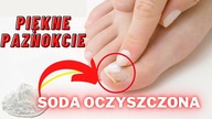 Sodę oczyszczoną nakładają na paznokcie rąk i stóp - Oto dlaczego