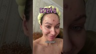 DZIEŃ 6 OSPA WIETRZNA #ospa #zdrowie #choroba #szpital #skincareroutine