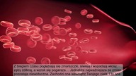 Oto jak szybko odblokujesz zatkane tętnice - Popraw przepływ krwi - SPRAWDZONE działające metody