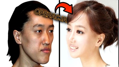10 NAJDROZSZYCH OPERACJI PLASTYCZNYCH