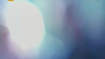 House M. D.  S05E07 The Itch