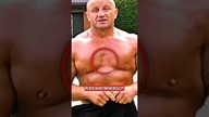 Co Się Dzieje z Klatą Mariusza Pudzianowskiego?