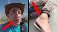 NAJGORSZE RANY otrzymane przez YOUTUBERÓW!