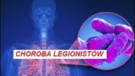 Choroba legionistów