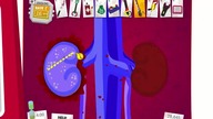 Amateur Surgeon Christmas Edition - przewodnik po grze (PC)