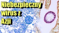 Naukowcy ostrzegają przed nową pandemią.  Śmiertelność wirusa Nipah sięga nawet 75%