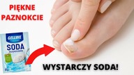 Nałóż sodę oczyszczoną na paznokcie rąk i nóg i zobacz co się stanie!