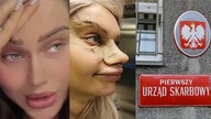 SKANDAL ze Skarbówką w tle! Celebrytka WYJAWIŁA PRAWDĘ o OPERACJACH w Turcji!
