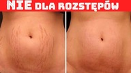 Twoje Rozstępy Znikną Dzięki Tym Metodom