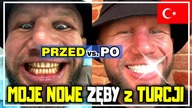 Hollywood smile - Licówki w Turcji (Zobaczcie jak wyglądał mój wyjazd do Stambułu) Flymedica [4k]