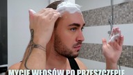 Mycie włosów po PRZESZCZEPIE  CiaRo UsaGo :D