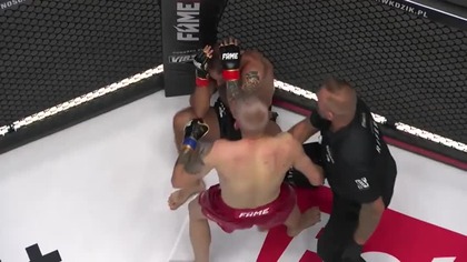 fame the freak (więcej darmowych gal opiśie)