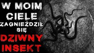 Dziwny Insekt zagnieździł się w moim ciele - Reddit CreepyPasta Lektor PL