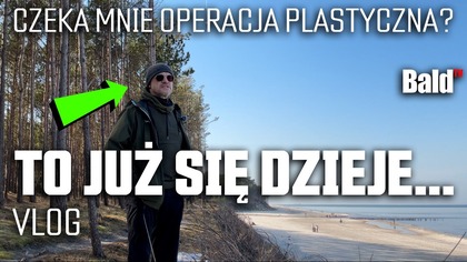 VLOG  AI wynajmuje ludzi do pracy a ja dostanę operację plastyczną 