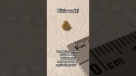 Jest moc! Ból niewyobrażalny Z tej okazji jutro film #kidneystone #sigma #sigmaboy #nerki