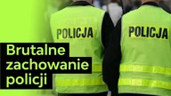 Stracił oko. Brutalne zachowanie policji | Bartek Brączek