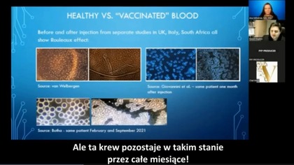 JEDNA KROPLA KRWI